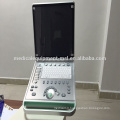 MSLPU24M Big Promotion 2016 New Laptop ultrasound machine doppler ultrasound machine price